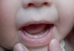 Методы лечения молочницы во рту у новорожденного
